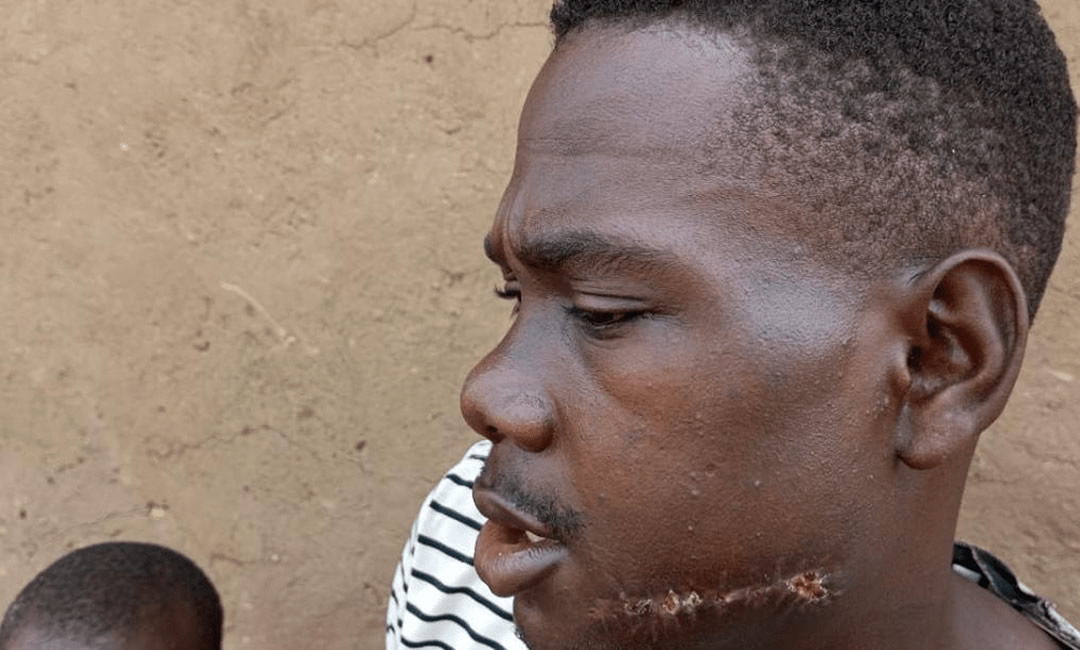 adf-survivor ADF Survivors